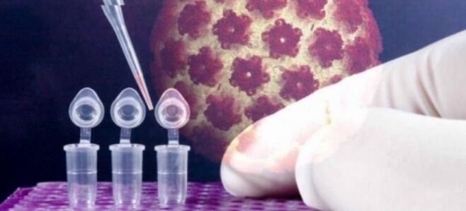 HPV diagnostika, izmantojot digēna testu